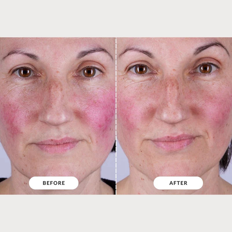 Radiant Skin Rejuvenator