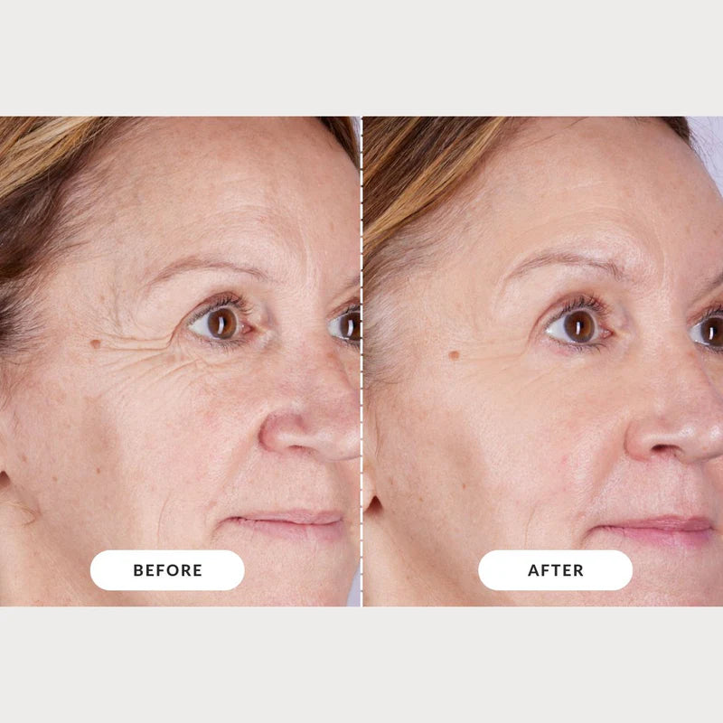 Radiant Skin Rejuvenator