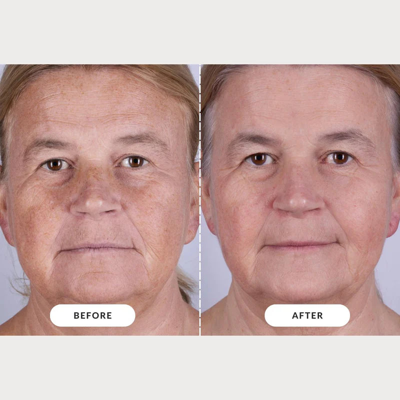 Radiant Skin Rejuvenator